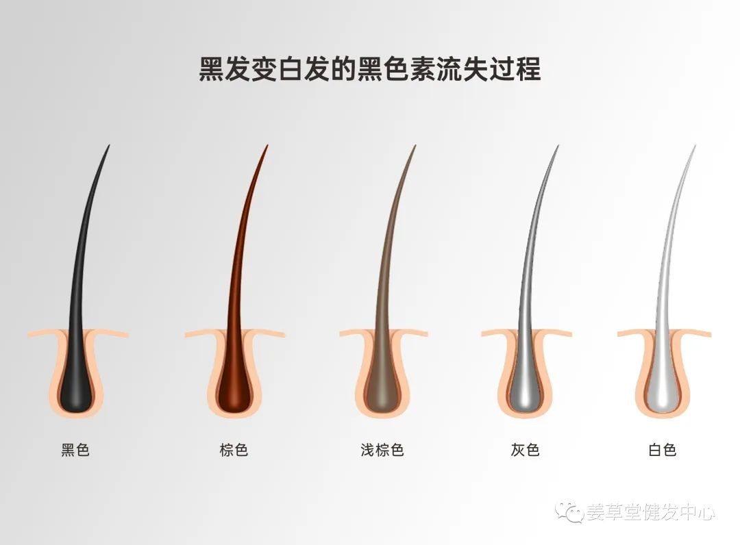 預防白發(fā)，先“補”後(hòu)“調”最重要